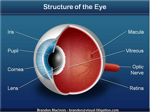 Medical malpractice litigation graphic - case-specific medical illustration.