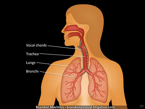 Medical malpractice illustration showing lungs and respiratory system.